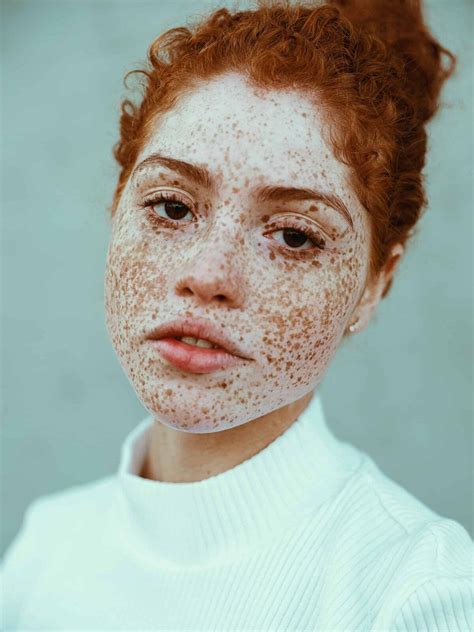 freckles images